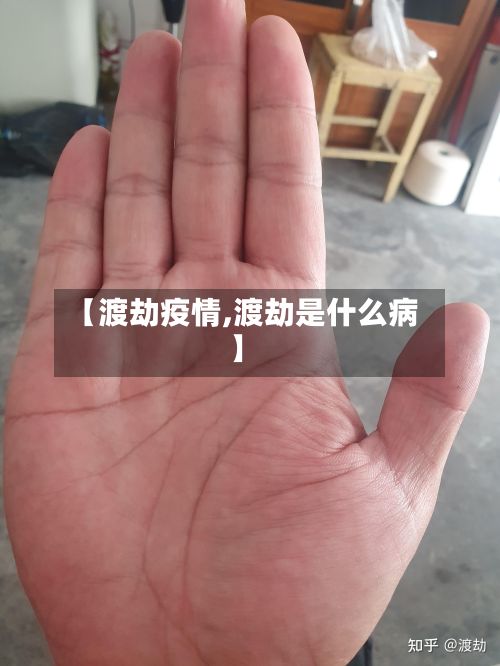 【渡劫疫情,渡劫是什么病】