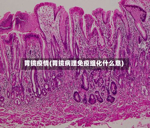 胃镜疫情(胃镜病理免疫组化什么意)-第2张图片