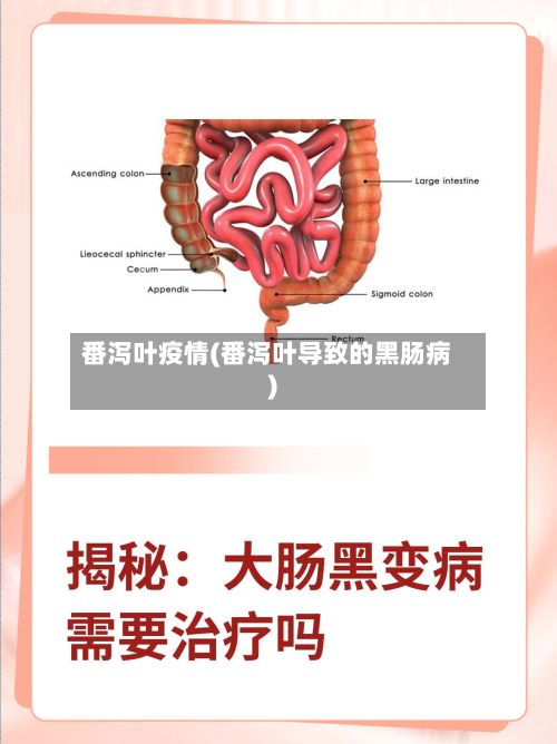 番泻叶疫情(番泻叶导致的黑肠病)-第2张图片