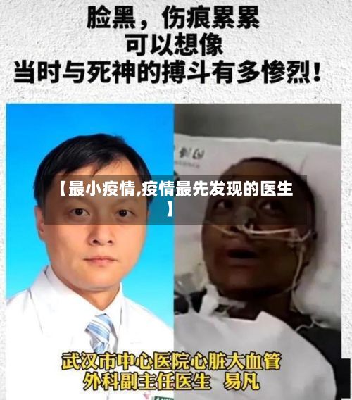 【最小疫情,疫情最先发现的医生】-第2张图片