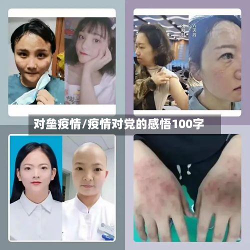 对垒疫情/疫情对党的感悟100字-第2张图片