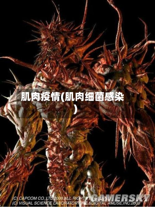 肌肉疫情(肌肉细菌感染)