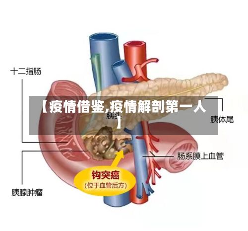 【疫情借鉴,疫情解剖第一人】-第2张图片